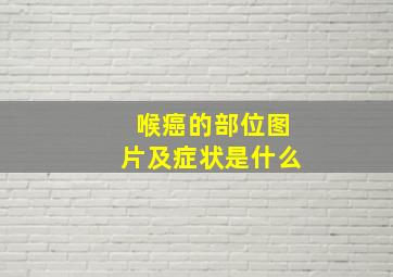 喉癌的部位图片及症状是什么