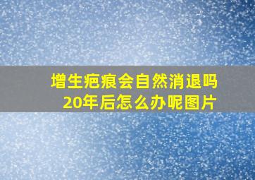 增生疤痕会自然消退吗20年后怎么办呢图片