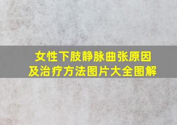 女性下肢静脉曲张原因及治疗方法图片大全图解