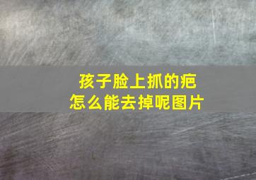 孩子脸上抓的疤怎么能去掉呢图片