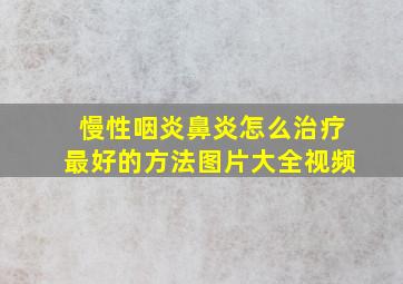 慢性咽炎鼻炎怎么治疗最好的方法图片大全视频