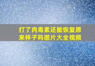 打了肉毒素还能恢复原来样子吗图片大全视频