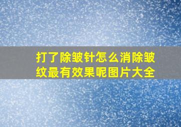 打了除皱针怎么消除皱纹最有效果呢图片大全