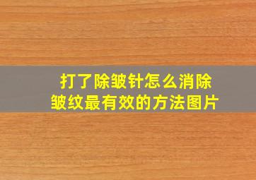 打了除皱针怎么消除皱纹最有效的方法图片