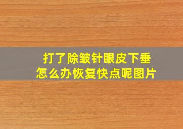 打了除皱针眼皮下垂怎么办恢复快点呢图片