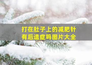 打在肚子上的减肥针有后遗症吗图片大全