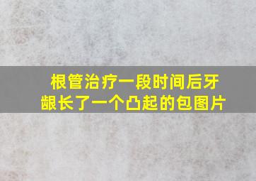 根管治疗一段时间后牙龈长了一个凸起的包图片