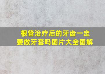 根管治疗后的牙齿一定要做牙套吗图片大全图解