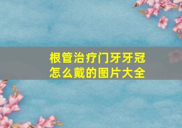 根管治疗门牙牙冠怎么戴的图片大全