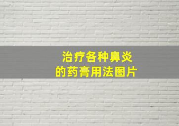 治疗各种鼻炎的药膏用法图片