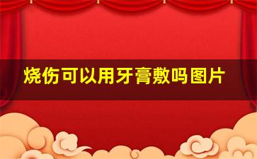 烧伤可以用牙膏敷吗图片