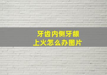 牙齿内侧牙龈上火怎么办图片