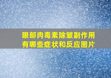 眼部肉毒素除皱副作用有哪些症状和反应图片