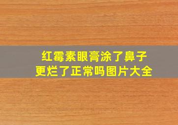 红霉素眼膏涂了鼻子更烂了正常吗图片大全