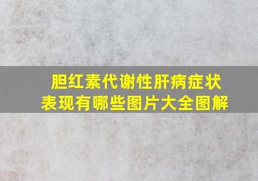 胆红素代谢性肝病症状表现有哪些图片大全图解