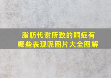 脂肪代谢所致的酮症有哪些表现呢图片大全图解