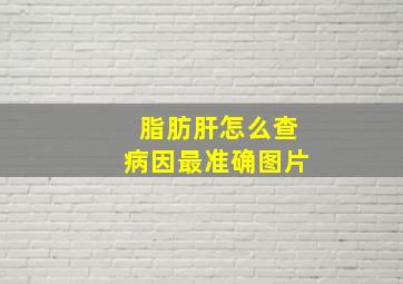 脂肪肝怎么查病因最准确图片