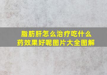 脂肪肝怎么治疗吃什么药效果好呢图片大全图解