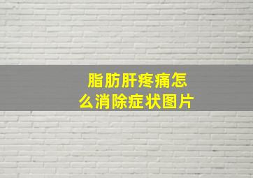 脂肪肝疼痛怎么消除症状图片