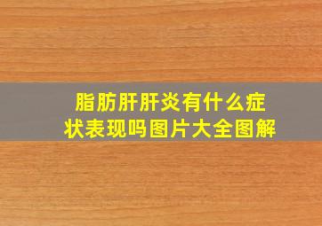 脂肪肝肝炎有什么症状表现吗图片大全图解