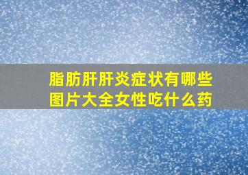 脂肪肝肝炎症状有哪些图片大全女性吃什么药