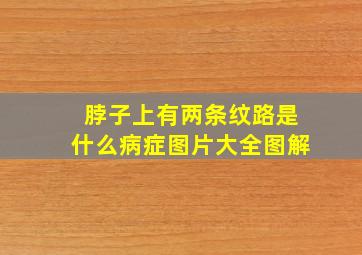 脖子上有两条纹路是什么病症图片大全图解