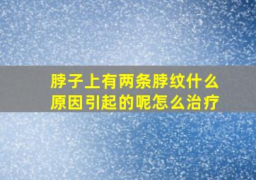 脖子上有两条脖纹什么原因引起的呢怎么治疗