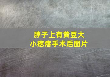 脖子上有黄豆大小疙瘩手术后图片