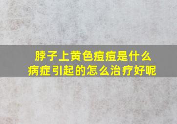 脖子上黄色痘痘是什么病症引起的怎么治疗好呢