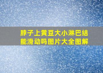 脖子上黄豆大小淋巴结能滑动吗图片大全图解