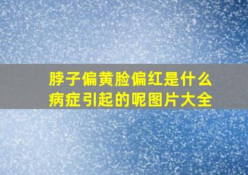 脖子偏黄脸偏红是什么病症引起的呢图片大全