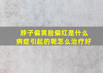 脖子偏黄脸偏红是什么病症引起的呢怎么治疗好