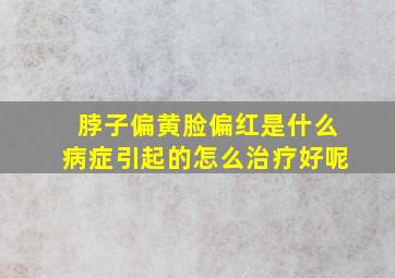 脖子偏黄脸偏红是什么病症引起的怎么治疗好呢