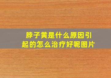 脖子黄是什么原因引起的怎么治疗好呢图片