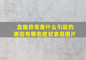 血脂异常是什么引起的原因有哪些症状表现图片