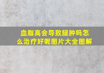 血脂高会导致腿肿吗怎么治疗好呢图片大全图解