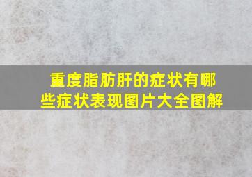 重度脂肪肝的症状有哪些症状表现图片大全图解