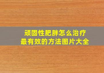 顽固性肥胖怎么治疗最有效的方法图片大全