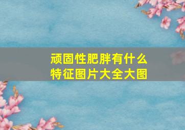 顽固性肥胖有什么特征图片大全大图