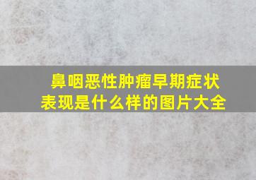 鼻咽恶性肿瘤早期症状表现是什么样的图片大全