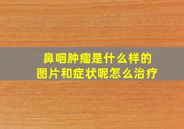 鼻咽肿瘤是什么样的图片和症状呢怎么治疗