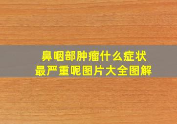 鼻咽部肿瘤什么症状最严重呢图片大全图解