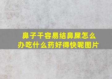 鼻子干容易结鼻屎怎么办吃什么药好得快呢图片