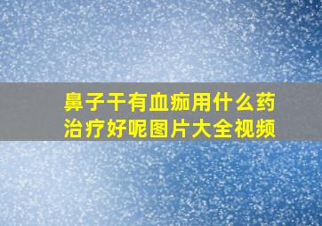 鼻子干有血痂用什么药治疗好呢图片大全视频