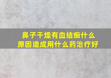 鼻子干燥有血结痂什么原因造成用什么药治疗好