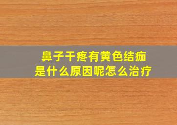 鼻子干疼有黄色结痂是什么原因呢怎么治疗