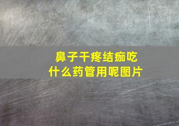 鼻子干疼结痂吃什么药管用呢图片