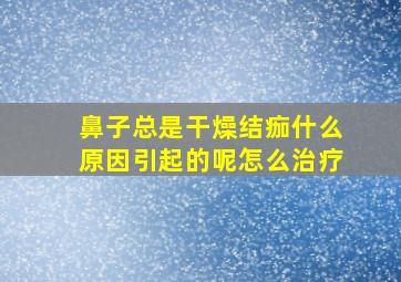 鼻子总是干燥结痂什么原因引起的呢怎么治疗