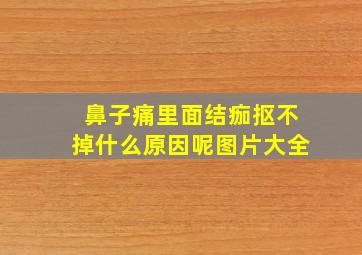 鼻子痛里面结痂抠不掉什么原因呢图片大全