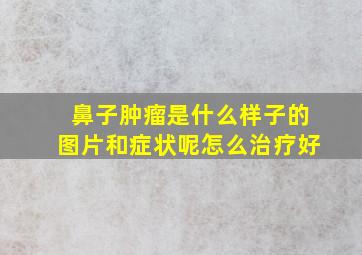 鼻子肿瘤是什么样子的图片和症状呢怎么治疗好